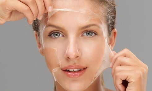 Un peeling profondo favorisce i processi di rigenerazione della pelle e la ringiovanisce